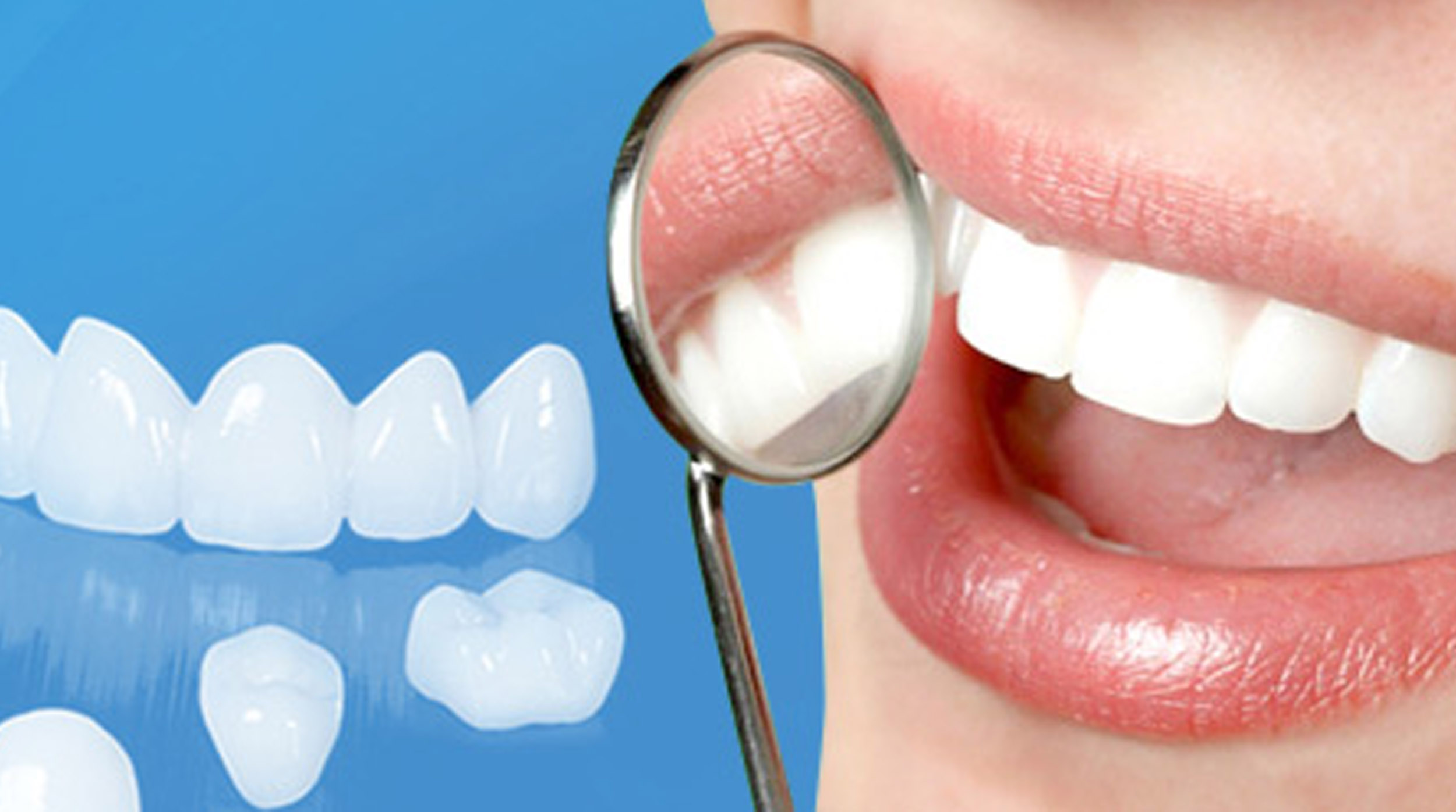 Cơ hội nghề nghiệp với Ngành Kỹ thuật phục hình răng