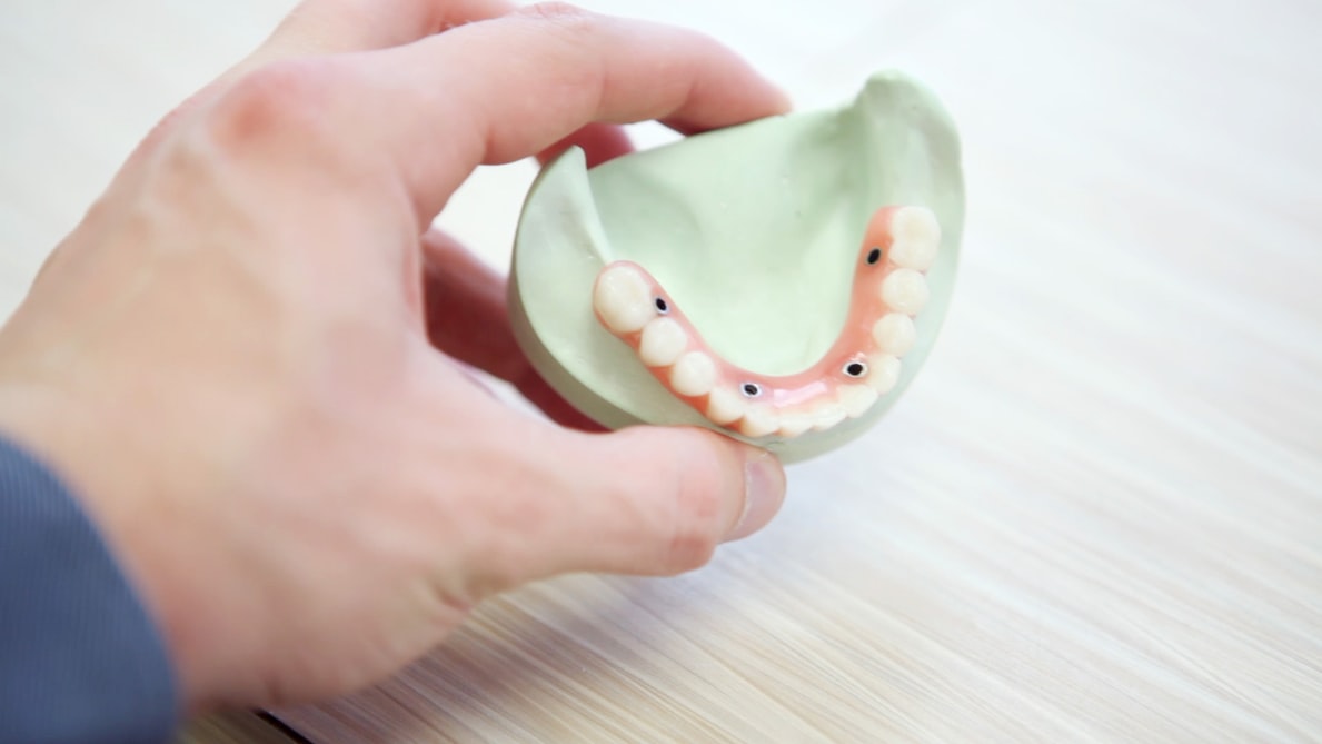 Hiểu về ngành Kỹ thuật phục hình răng
